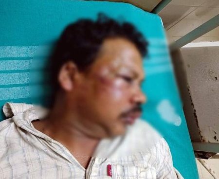 ಬೆಳ್ತಂಗಡಿ: ಬಾಲಕಿಗೆ ಲೈಂಗಿಕ ಕಿರುಕುಳ ಆರೋಪಿ ಸೇರಿ ಇಬ್ಬರಿಗೆ ಹಲ್ಲೆ; ಜಗಳ ಬಿಡಿಸಲು ಬಂದಾತ ಮೃತ್ಯು