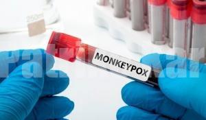 ಮಂಕಿಪಾಕ್ಸ್ ಸೋಂಕು ಪತ್ತೆಗೆ ಪರೀಕ್ಷಾ ಕಿಟ್ ಬಿಡುಗಡೆ