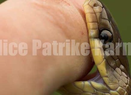 ಕಾರ್ಕಳ: ಉರಗತಜ್ಞ ಅನಿಲ್ ಪ್ರಭುಗೆ ಹಾವು ಕಡಿತ: ಸ್ಥಿತಿ ಗಂಭೀರ