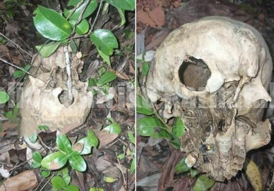 ವಿಟ್ಲ : ಗುಡ್ಡದಲ್ಲಿ ವ್ಯಕ್ತಿಯೊಬ್ಬರ ತಲೆಬುರುಡೆ, ಎಲುಬು ಪತ್ತೆ!