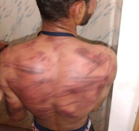 ಸುಳ್ಯ: ಹುಡುಗಿ ಜೊತೆ ಮಾತನಾಡಿದ್ದಕ್ಕೆ ಕಾಲೇಜು ವಿದ್ಯಾರ್ಥಿಗೆ ಮಾರಣಾಂತಿಕ ಹಲ್ಲೆ!