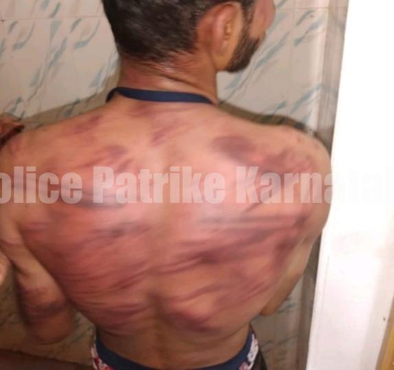 ಸುಳ್ಯ: ಹುಡುಗಿ ಜೊತೆ ಮಾತನಾಡಿದ್ದಕ್ಕೆ ಕಾಲೇಜು ವಿದ್ಯಾರ್ಥಿಗೆ ಮಾರಣಾಂತಿಕ ಹಲ್ಲೆ!