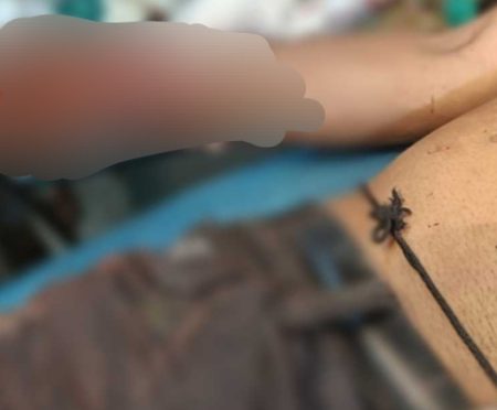 ಮಂಗಳೂರು: ಯುವಕನೋರ್ವನ ಕೊಲೆಯತ್ನ, ಸ್ಥಿತಿ ಚಿಂತಾಜನಕ