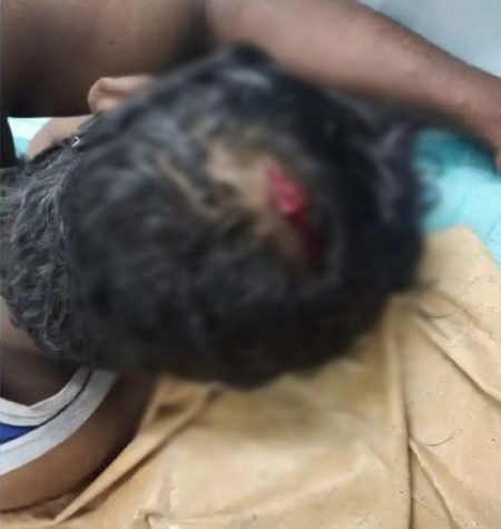 ಮನೆಯ ವಿದ್ಯುತ್ ಬಿಲ್ ಪಾವತಿಸದ ಹಿನ್ನಲೆಯಲ್ಲಿ ಫ್ಯೂಸ್ ತೆಗೆದ ವಿವಾದ: ಮೆಸ್ಕಾಂ ಪವರ್ ಮ್ಯಾನ್ ಮೇಲೆ ಹಲ್ಲೆ