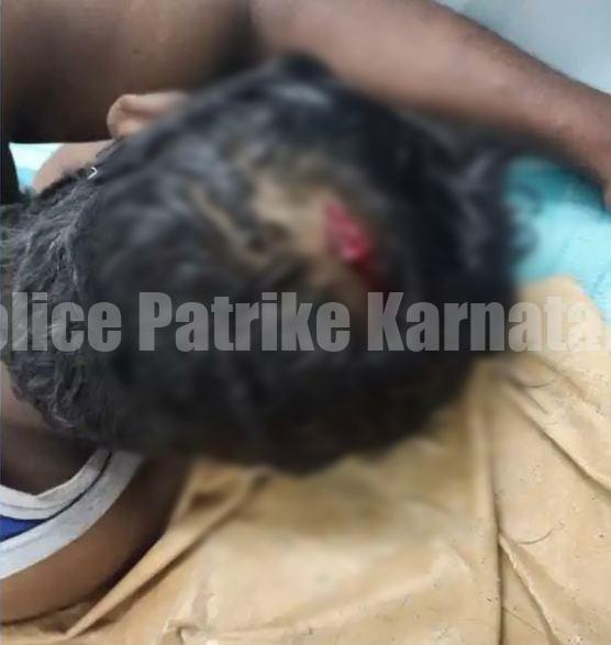 ಮನೆಯ ವಿದ್ಯುತ್ ಬಿಲ್ ಪಾವತಿಸದ ಹಿನ್ನಲೆಯಲ್ಲಿ ಫ್ಯೂಸ್ ತೆಗೆದ ವಿವಾದ: ಮೆಸ್ಕಾಂ ಪವರ್ ಮ್ಯಾನ್ ಮೇಲೆ ಹಲ್ಲೆ