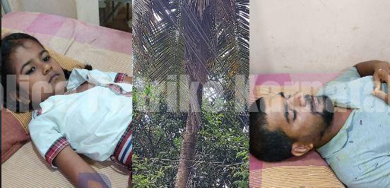 ಉಳ್ಳಾಲ: ಕಣಜದ ಹುಳಗಳ ದಾಳಿ; ತೆಂಗಿನ ಕಾಯಿ ಕೀಳುತ್ತಿದ್ದ ವ್ಯಕ್ತಿ ಕೆಳಕ್ಕೆ ಬಿದ್ದು ಗಂಭೀರ ಗಾಯ