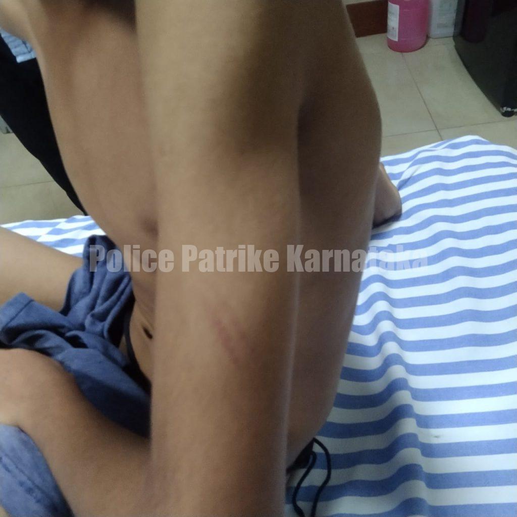 ಮಂಗಳೂರು: ಮದರಸ ಶಿಕ್ಷಕನಿಂದ ಬಾಲಕನಿಗೆ ದೈಹಿಕ ಹಲ್ಲೆ ಮತ್ತು ಕಿರುಕುಳ