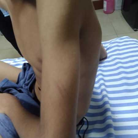 ಮಂಗಳೂರು: ಮದರಸ ಶಿಕ್ಷಕನಿಂದ ಬಾಲಕನಿಗೆ ದೈಹಿಕ ಹಲ್ಲೆ ಮತ್ತು ಕಿರುಕುಳ