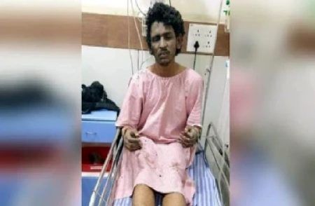 ಆಟೋದಲ್ಲಿ ಕುಕ್ಕರ್ ಬಾಂಬ್ ಬ್ಲಾಸ್ಟ್ ಕೇಸ್ : ಶಾರೀಕ್ಗೆ ವೆಂಟಿಲೇಟರ್ನಲ್ಲಿ ಚಿಕಿತ್ಸೆ, 8 ಮಂದಿ ವೈದ್ಯರಿಂದ ನಿಗಾ