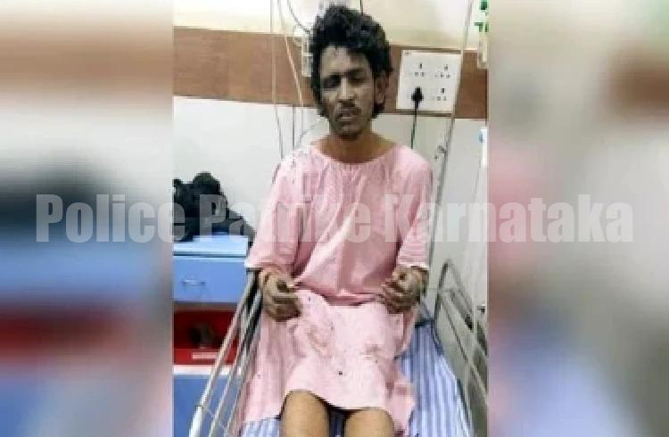 ಆಟೋದಲ್ಲಿ ಕುಕ್ಕರ್ ಬಾಂಬ್ ಬ್ಲಾಸ್ಟ್ ಕೇಸ್ : ಶಾರೀಕ್ಗೆ ವೆಂಟಿಲೇಟರ್ನಲ್ಲಿ ಚಿಕಿತ್ಸೆ, 8 ಮಂದಿ ವೈದ್ಯರಿಂದ ನಿಗಾ