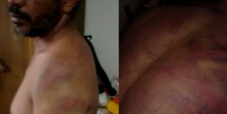 ಬಿಸಿರೋಡು ನಿವಾಸಿ ಬಸ್ ಪ್ರಯಾಣಿಕನಿಗೆ ಸಂಘಪರಿವಾರದ ಕಾರ್ಯಕರ್ತರಿಂದ ಮಾರಣಾಂತಿಕ ಹಲ್ಲೆ