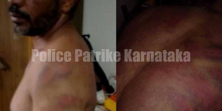 ಬಿಸಿರೋಡು ನಿವಾಸಿ ಬಸ್ ಪ್ರಯಾಣಿಕನಿಗೆ ಸಂಘಪರಿವಾರದ ಕಾರ್ಯಕರ್ತರಿಂದ ಮಾರಣಾಂತಿಕ ಹಲ್ಲೆ