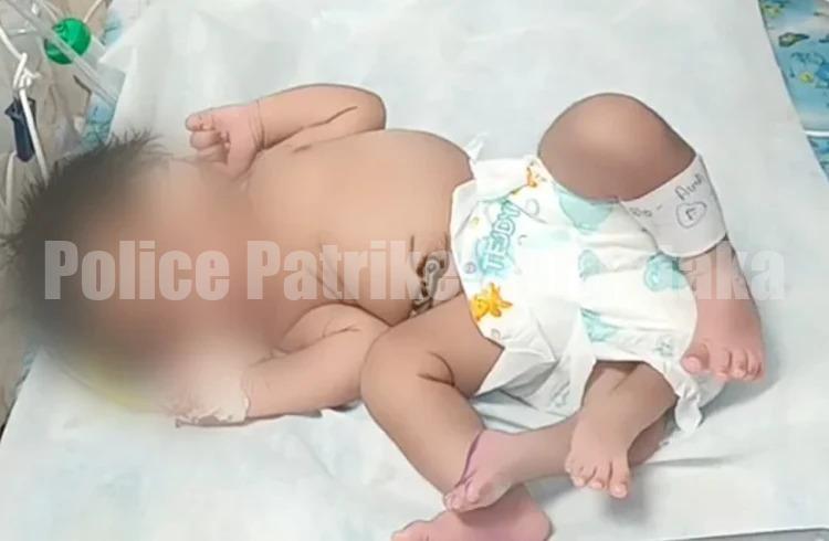 ಮಧ್ಯಪ್ರದೇಶ: ʻನಾಲ್ಕು ಕಾಲುʼಗಳೊಂದಿಗೆ ಹೆಣ್ಣು ಮಗು ಜನನ