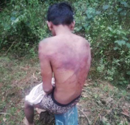 ಹಿಂದೂ ಹುಡುಗಿಯ ಹಿಂದೆ ಹೋದ ಅನ್ಯಕೋಮಿನ ಹುಡುಗನಿಗೆ ಹಿಗ್ಗಾ ಮುಗ್ಗಾ ಥಳಿತ -ಗಂಭೀರ, ಆಸ್ಪತ್ರೆಗೆ ದಾಖಲು