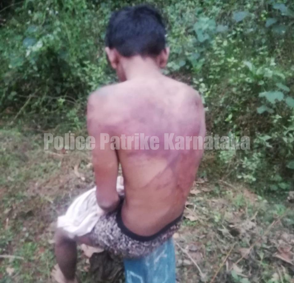 ಹಿಂದೂ ಹುಡುಗಿಯ ಹಿಂದೆ ಹೋದ ಅನ್ಯಕೋಮಿನ ಹುಡುಗನಿಗೆ ಹಿಗ್ಗಾ ಮುಗ್ಗಾ ಥಳಿತ -ಗಂಭೀರ, ಆಸ್ಪತ್ರೆಗೆ ದಾಖಲು