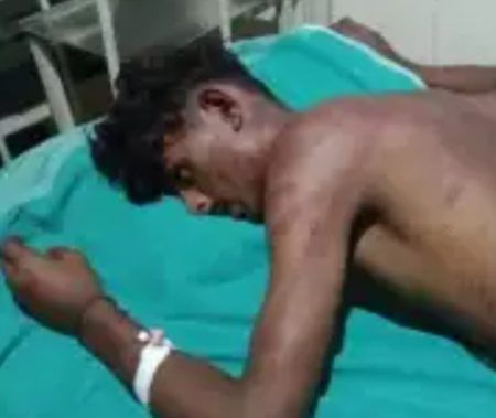 ಪುತ್ತೂರು: ನೈತಿಕ ಪೊಲೀಸ್ ಗಿರಿ- ಸಹಪಾಠಿ ವಿಧ್ಯಾರ್ಥಿನಿ ಜೊತೆ ಇದ್ದ ವಿಧ್ಯಾರ್ಥಿ ಮೇಲೆ ತಂಡದಿಂದ ಹಲ್ಲೆ