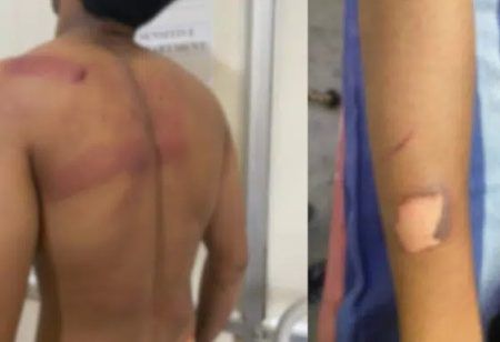 ಮಂಗಳೂರು: ಖಾಸಗಿ ಕಾಲೇಜು ವಿದ್ಯಾರ್ಥಿಯ ಮೇಲೆ ನೈತಿಕ ಪೊಲೀಸ್ ಗಿರಿ- ಪ್ರಕರಣ ದಾಖಲು