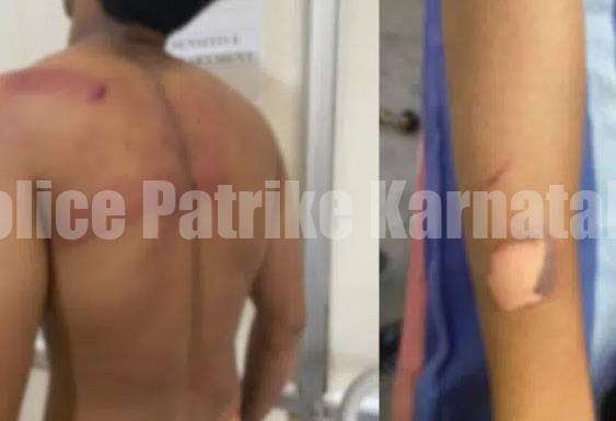 ಮಂಗಳೂರು: ಖಾಸಗಿ ಕಾಲೇಜು ವಿದ್ಯಾರ್ಥಿಯ ಮೇಲೆ ನೈತಿಕ ಪೊಲೀಸ್ ಗಿರಿ- ಪ್ರಕರಣ ದಾಖಲು