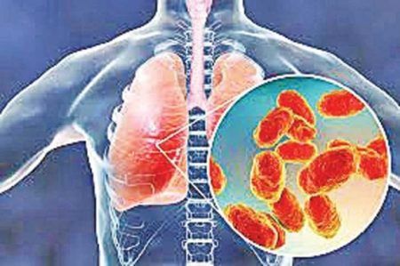 ನ್ಯೂಮೋನಿಯಾ ವೈರಸ್ ಬಾಧೆ- ದಕ್ಷಿಣ ಕನ್ನಡ ಜಿಲ್ಲೆಯಲ್ಲಿ ಆರೋಗ್ಯ ಇಲಾಖೆ ಅಲರ್ಟ್