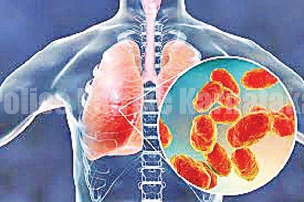 ನ್ಯೂಮೋನಿಯಾ ವೈರಸ್ ಬಾಧೆ- ದಕ್ಷಿಣ ಕನ್ನಡ ಜಿಲ್ಲೆಯಲ್ಲಿ ಆರೋಗ್ಯ ಇಲಾಖೆ ಅಲರ್ಟ್