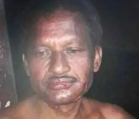 ಉಡುಪಿ: ಮನೆಯ ಜಗಲಿಯಲ್ಲಿ ಮಲಗಿದ್ದ ವ್ಯಕ್ತಿ ಮೇಲೆ ಚಿರತೆ ದಾಳಿ- ಗಂಭೀರ ಗಾಯ