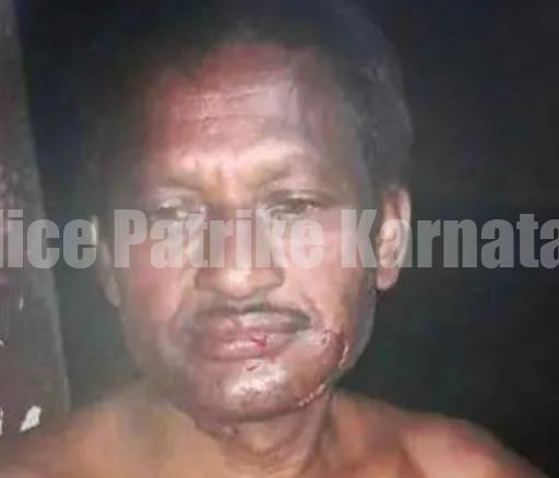 ಉಡುಪಿ: ಮನೆಯ ಜಗಲಿಯಲ್ಲಿ ಮಲಗಿದ್ದ ವ್ಯಕ್ತಿ ಮೇಲೆ ಚಿರತೆ ದಾಳಿ- ಗಂಭೀರ ಗಾಯ