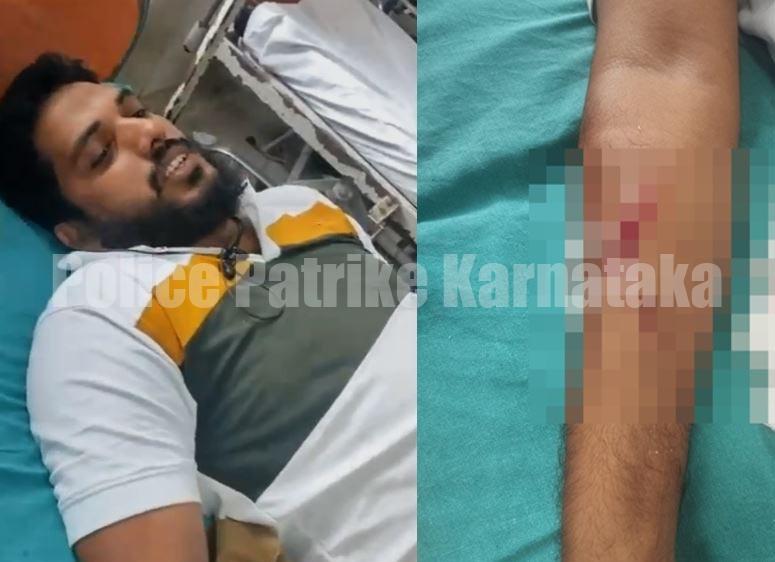 ಪಣಂಬೂರು: ರಿಕ್ಷಾ ಚಾಲಕನಿಗೆ ಮಾರಕಾಸ್ತ್ರದಿಂದ ಹಲ್ಲೆ