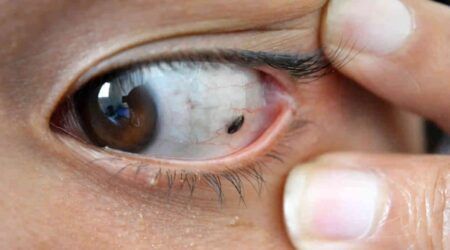 ನಿಮ್ಮ ಕಣ್ಣಿನಲ್ಲಿ ಚಿಕ್ಕ ವ್ಯತ್ಯಾಸ ಕಂಡುಬಂದರೂ ನಿರ್ಲಕ್ಷಿಸಬೇಡಿ : ಕ್ಯಾನ್ಸರ್ ರೋಗಲಕ್ಷಣಗಳಿರಬಹುದು.!