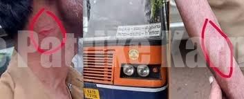 ಉಪ್ಪಿನಂಗಡಿ: ಟಿಕೆಟ್ ವಿಚಾರಕ್ಕೆ ಕಂಡೆಕ್ಟರ್ ಮೇಲೆ ಪ್ರಯಾಣಿಕನಿಂದ ಹಲ್ಲೆ..!