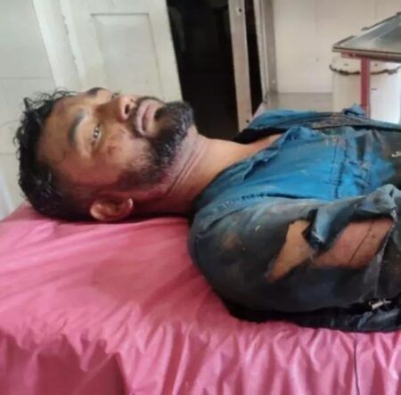 ಪುತ್ತೂರು ಸ್ಕೂಟರ್ ಸವಾರನ ಮೇಲೆ ಕಾಡು ಹಂದಿ ದಾಳಿ, ಗಂಭೀರ ಗಾಯ..!