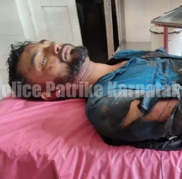 ಪುತ್ತೂರು ಸ್ಕೂಟರ್ ಸವಾರನ ಮೇಲೆ ಕಾಡು ಹಂದಿ ದಾಳಿ, ಗಂಭೀರ ಗಾಯ..!
