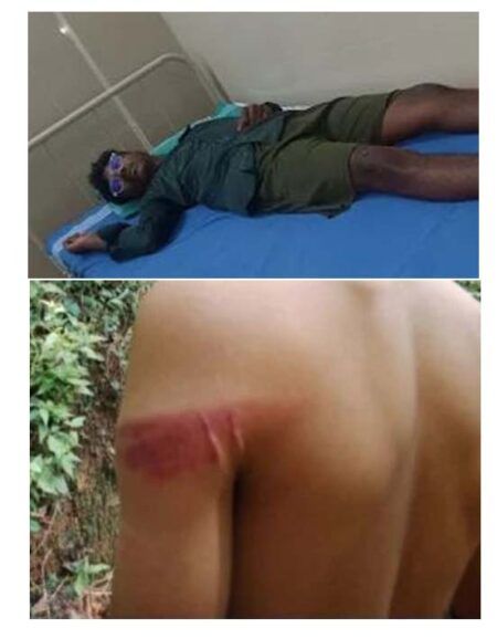 ಕಡಬ: ವಿದ್ಯಾರ್ಥಿಗಳಿಗೆ ಹಿಗ್ಗಾಮುಗ್ಗ ಥಳಿಸಿದ ಉಪನ್ಯಾಸಕ- ಓರ್ವ ಆಸ್ಪತ್ರೆಗೆ ದಾಖಲು