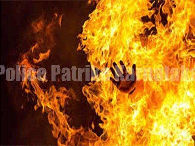 ಪುತ್ತೂರು: ತಮ್ಮನಿಂದ ಬೆಂಕಿ ದಾಳಿ — ಗಂಭೀರ ಗಾಯಗೊಂಡ ಅಣ್ಣ ಆಸ್ಪತ್ರೆಗೆ ದಾಖಲು