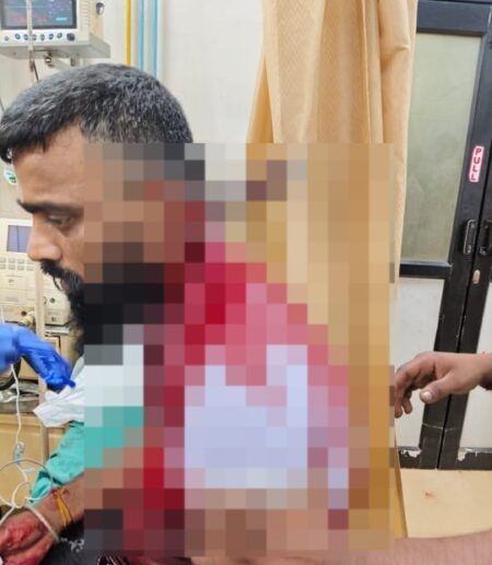 ಯುವಕನಿಗೆ ಚಾಕು ಇರಿದು ಪರಾರಿಯಾದ ದುಷ್ಕರ್ಮಿಗಳು..!!