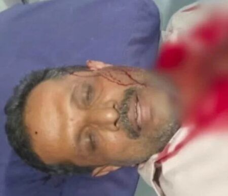 ಮಂಗಳೂರು: ಗ್ರಾಹಕಿ ಸೋಗಿನಲ್ಲಿ ಬುರ್ಖಾ ಧರಿಸಿ ಬಂದು ಪತಿಯ ಮೇಲೆ ಕತ್ತಿಯಿಂದ ಹಲ್ಲೆ