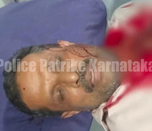 ಮಂಗಳೂರು: ಗ್ರಾಹಕಿ ಸೋಗಿನಲ್ಲಿ ಬುರ್ಖಾ ಧರಿಸಿ ಬಂದು ಪತಿಯ ಮೇಲೆ ಕತ್ತಿಯಿಂದ ಹಲ್ಲೆ