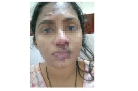 ಸುಳ್ಯ: ಯುವತಿಯ ಮೇಲೆ ಪತಿ ಸೇರಿ ಮೂವರಿಂದ ಹಲ್ಲೆ..!! ಪ್ರಕರಣ ದಾಖಲು