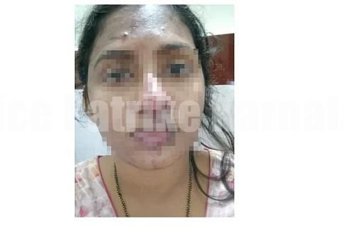 ಸುಳ್ಯ: ಯುವತಿಯ ಮೇಲೆ ಪತಿ ಸೇರಿ ಮೂವರಿಂದ ಹಲ್ಲೆ..!! ಪ್ರಕರಣ ದಾಖಲು