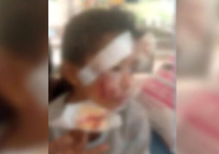 ಬಂಟ್ವಾಳ: ಅಂಗನವಾಡಿಗೆ ತೆರಳುತ್ತಿದ್ದ ಮಗುವಿನ ಮೇಲೆ ಬೀದಿನಾಯಿ ದಾಳಿ