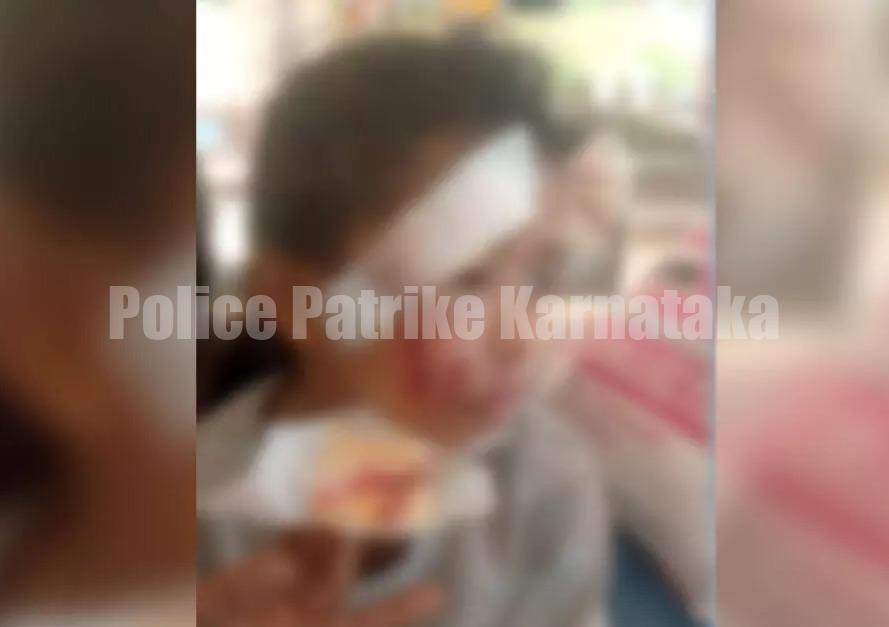 ಬಂಟ್ವಾಳ: ಅಂಗನವಾಡಿಗೆ ತೆರಳುತ್ತಿದ್ದ ಮಗುವಿನ ಮೇಲೆ ಬೀದಿನಾಯಿ ದಾಳಿ