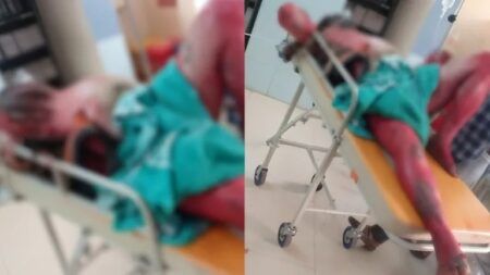 ಬೆಳ್ತಂಗಡಿ: ಪೆಟ್ರೋಲ್ ಸುರಿದು ಬೆಂಕಿ ಹಚ್ಚಿಕೊಂಡು ಆತ್ಮಹತ್ಯೆಗೆ ಯತ್ನ..!!