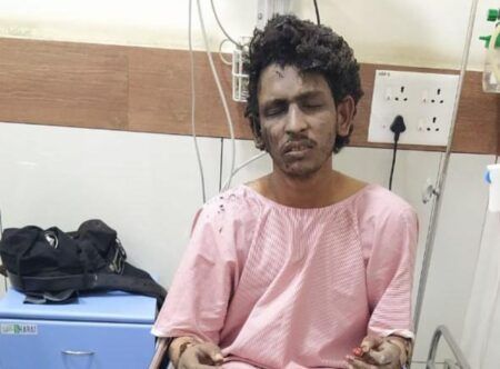 ಮಂಗಳೂರು ಕುಕ್ಕರ್ ಬಾಂಬ್ ಸ್ಫೋಟ ಪ್ರಕರಣ: ಶಾರೀಕ್ಗೆ 10 ವರ್ಷ ಕಠಿಣ ಜೈಲು ಶಿಕ್ಷೆ